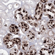 NBP1-81283 - HYAL2 / Hyaluronidase-2
