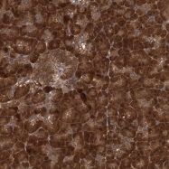 NBP1-81659 - Hydroxypyruvate isomerase / HYI