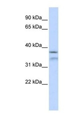 NBP1-56899 - HYLS1 / HLS