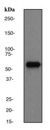 NB100-79963 - HCK