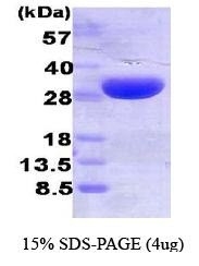 NBC1-22928 - Heme oxygenase 1 / HMOX1