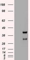 NBP1-47792 - HHEX / PRH
