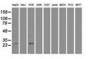 NBP1-47792 - HHEX / PRH