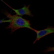 NBP1-51644 - Hexokinase-1