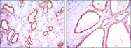 NBP1-51644 - Hexokinase-1