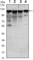 NBP1-51644 - Hexokinase-1