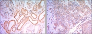 NBP1-51639 - Hexokinase-1
