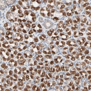 NBP1-85789 - Hexokinase-1