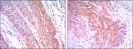 NBP1-51643 - Hexokinase-2