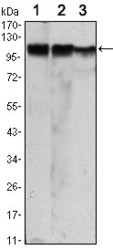 NBP1-51643 - Hexokinase-2
