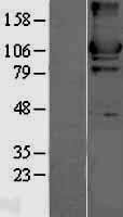 NBL1-11579 - Hexokinase II Lysate