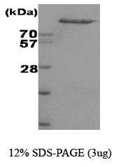 NBC1-18389 - Hexokinase-2