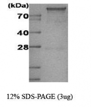 NBC1-18390 - Hexokinase-1