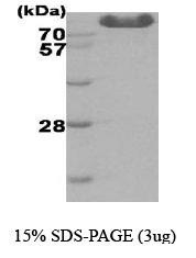 NBC1-18387 - Hexokinase-3