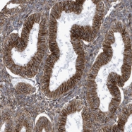 NBP1-90058 - Histamine H4 receptor