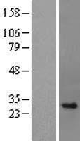 NBL1-11555 - Histone H1.4 Lysate