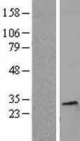 NBL1-11552 - Histone H1.5 Lysate