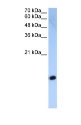 NBP1-58094 - Histone H2A type 2-C