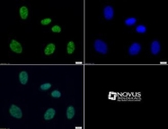 NB21-1092 - Histone H3.2