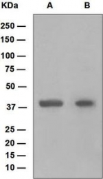 NBP1-95742 - HOXB5 / HOX2A