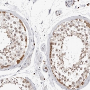 NBP1-89662 - Heat shock protein 105 / HSP105