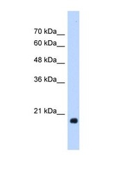 NBP1-55523 - Heat shock protein beta-6 / HSPB6