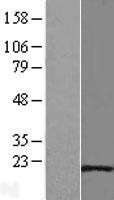 NBL1-11759 - Hsp20 Lysate