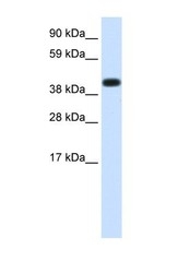 NBP1-56505 - Heat shock protein 70 / HSP70