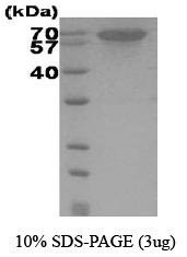 NBC1-18367 - Heat shock protein 70 / HSP70