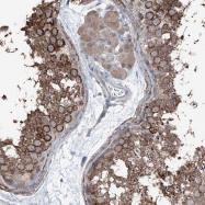 NBP1-88332 - HSPB11
