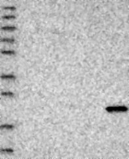 NBP1-81697 - HSPB2