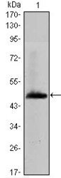 NBP1-51635 - Hyaluronic acid synthase 1 / HAS1