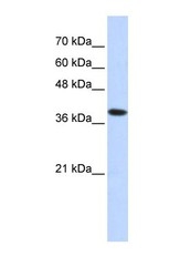 NBP1-60028 - ATP4B