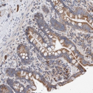 NBP1-84637 - Isoleucyl-tRNA synthetase / IARS2