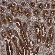 NBP1-84638 - Isoleucyl-tRNA synthetase / IARS2