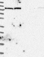 NBP1-84637 - Isoleucyl-tRNA synthetase / IARS2