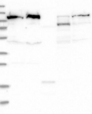 NBP1-84638 - Isoleucyl-tRNA synthetase / IARS2