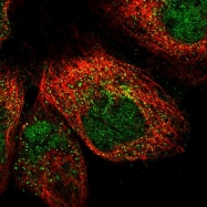 NBP1-83124 - Islet cell autoantigen 1 / ICA1
