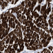 NBP1-83124 - Islet cell autoantigen 1 / ICA1