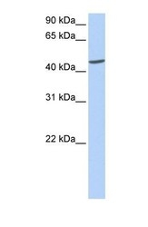 NBP1-55450 - Islet cell autoantigen 1 / ICA1