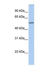 NBP1-56426 - Islet cell autoantigen 1 / ICA1
