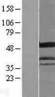 NBL1-11802 - ICA1 Lysate