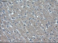 NBP1-47803 - ID2 / BHLHB26