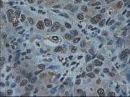NBP1-47803 - ID2 / BHLHB26