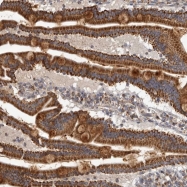 NBP1-88630 - ID2 / BHLHB26