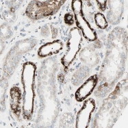NBP1-85784 - Isocitrate dehydrogenase / IDH2