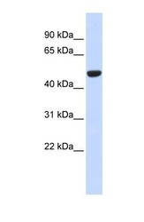 NBP1-54779 - Isocitrate dehydrogenase / IDH2