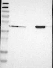 NBP1-85784 - Isocitrate dehydrogenase / IDH2