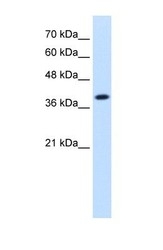 NBP1-54736 - Isocitric dehydrogenase alpha / IDH3A