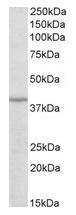 NBP1-78787 - Isocitric dehydrogenase beta / IDH3B